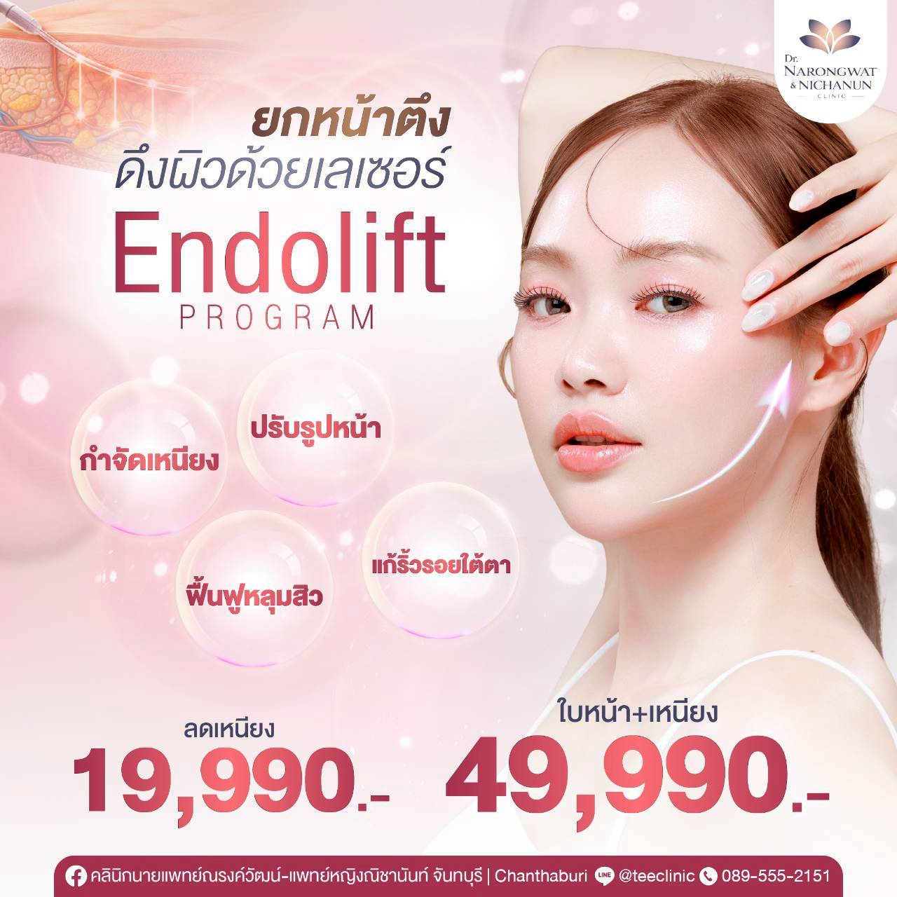 LINE_ALBUM_EndoLift_260717_2